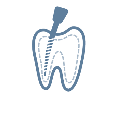 Wurzelkanalbehandlung (Endodontie)
